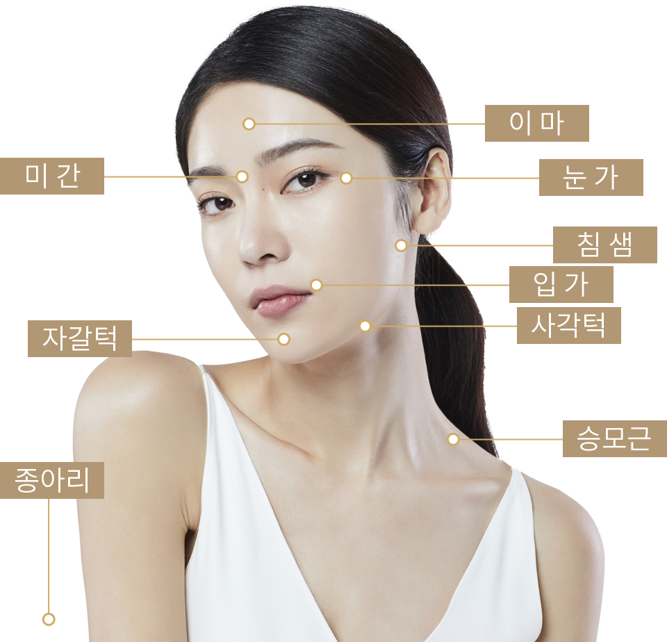 보톡스 시술부위