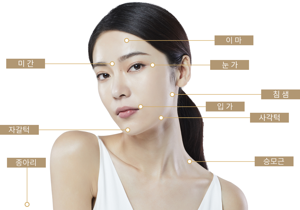 보톡스 시술부위